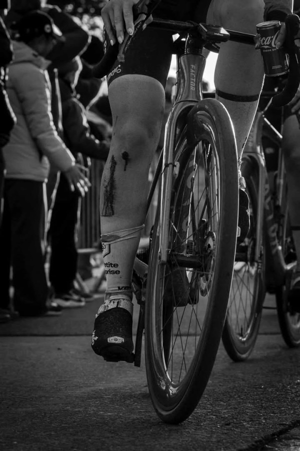03-Margot-blessure-kamil-cycling-photos-69b541a481393.jpg